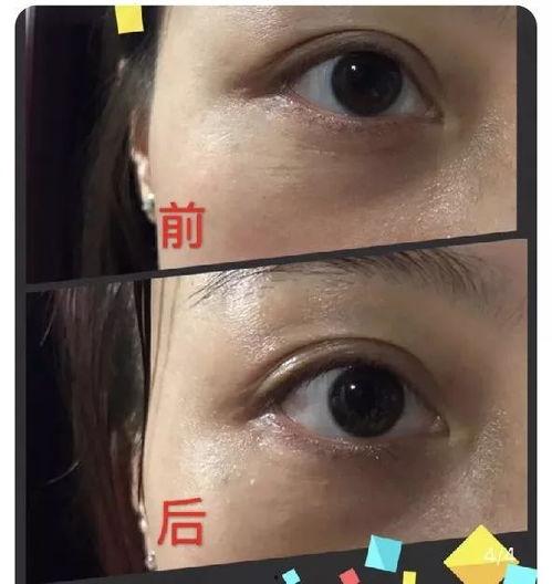 腰子脸的女明星,揭秘娱乐圈的神秘魅力